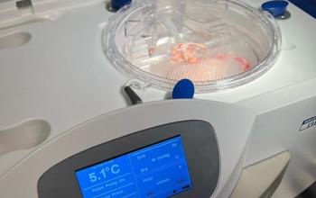 Primo trapianto di rene in Campania con utilizzo della Machine Perfusion 
